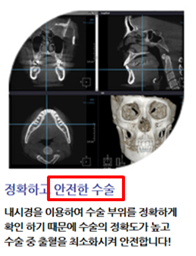 부작용을 부정하는 안전한 수술이라는 의료광고는 모니터링 대상이다. (복지부 예시 사진)