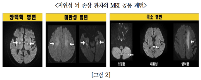 출처 서울아산병원