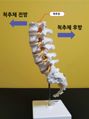 척추 측면(자료 제공: 국제성모병원)