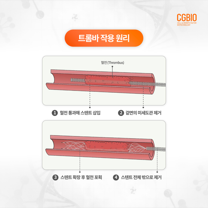트롬바 작용 원리