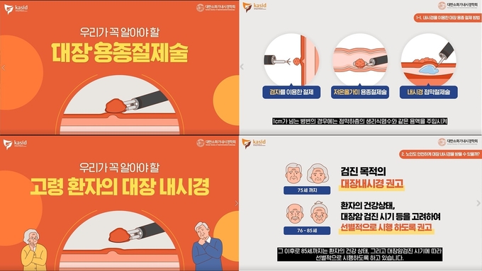 대한소화기내시경학회와 대한장연구학회가 대장암 조기 발견 및 예방을 위한 두 개의 유튜브 영상을 공개했다.